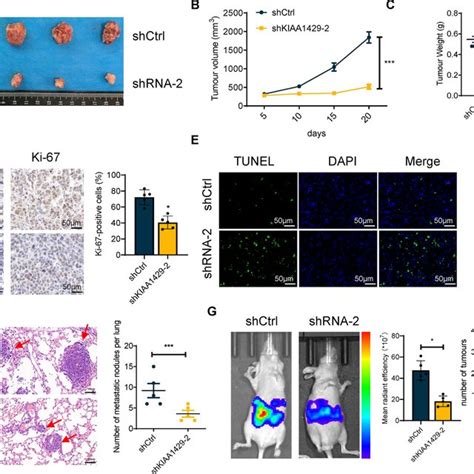 Kiaa1429 Promoted Cell Proliferation And Metastasis In Vivo The Photos