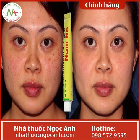 Thuốc Erythromycin And Nghệ Nam Hà Có Tốt Không Mua ở đâu Giá Bao Nhiêu