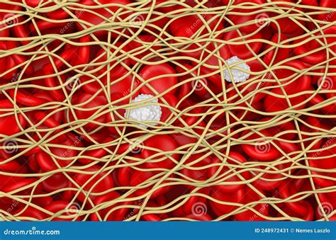 Areas Of The Body Psoriasis Man Nude Character Vector Illustration CartoonDealer