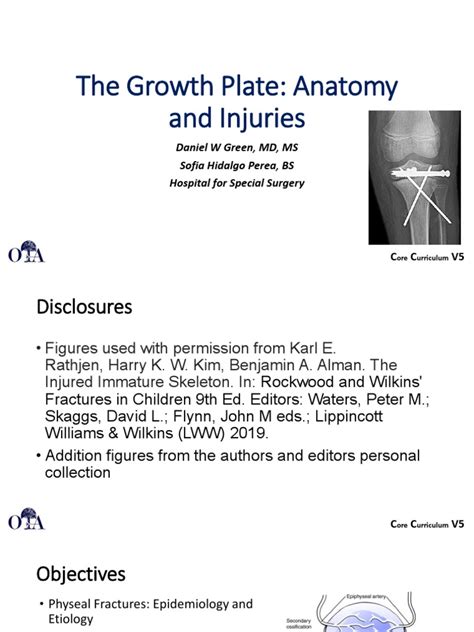 The Growth Plate Anatomy And Injuries Daniel W Green Md Ms Sofia