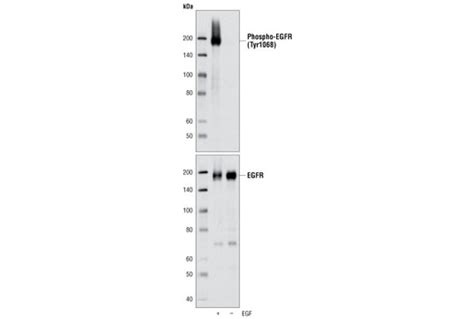 Phospho Egf Receptor Tyr D A Xp Rabbit Mab Cell Signaling