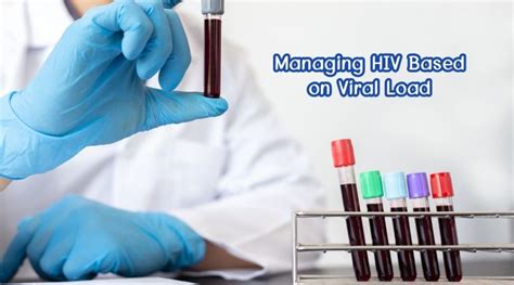 Understanding Hiv Viral Load The Hiv Map