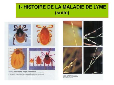 Ppt Borreliose De Lyme Place De La S Rologie Dans Le Diagnostic