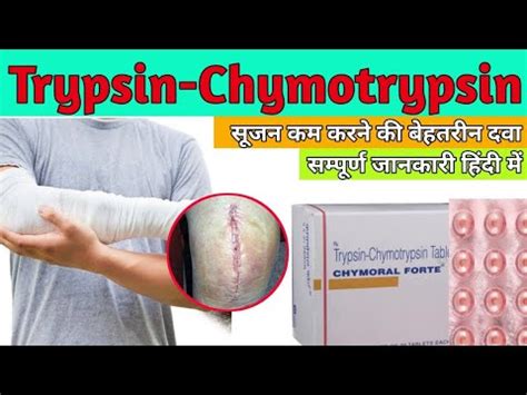 Trypsin Chymotrypsin Tablet Uses In Hindi Chymoral Forte Tablet Uses