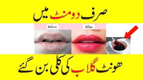 Get Naturally Pink Lips In Two Minutes Hont Gulabi Karne Ka Totka