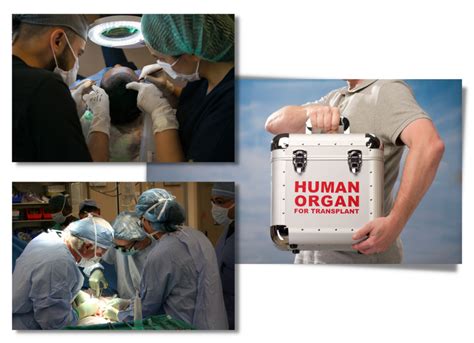 Organ Transplant Surgery In India Human Approach