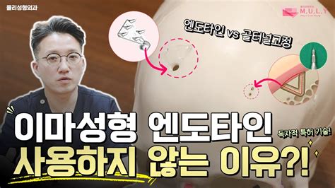 특허받은 이마 수술은 뭐가 달라 뮬리만의 특별한 이마성형 엔도타인 사용하지 않는 이유 Youtube