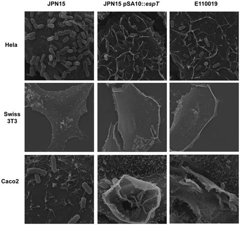 Scanning Electron Microscopy Of HeLa Swiss 3T3 And Polarized Caco2