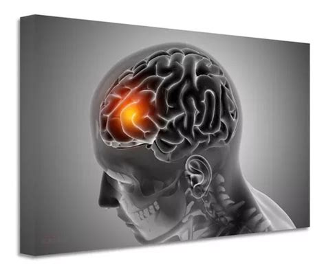 Cuadro Neurología Cerebro Canvas Grueso Cng5 60x40 Envío gratis