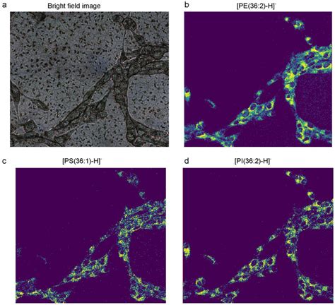 Bright Field And T Maldi 2 Msi Data Of Cultured Vero B4 Cells In The Download Scientific