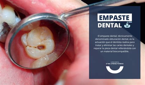 Periimplantitis Qué Es Síntomas Y Tratamiento