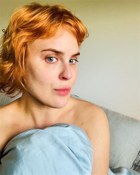 Tallulah Willis Dissolves Filler Shows Real Bone Structure