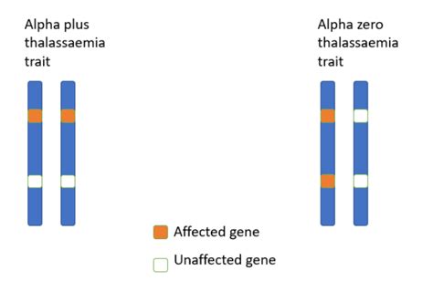 Thalassaemia Alpha Beta Geeky Medics