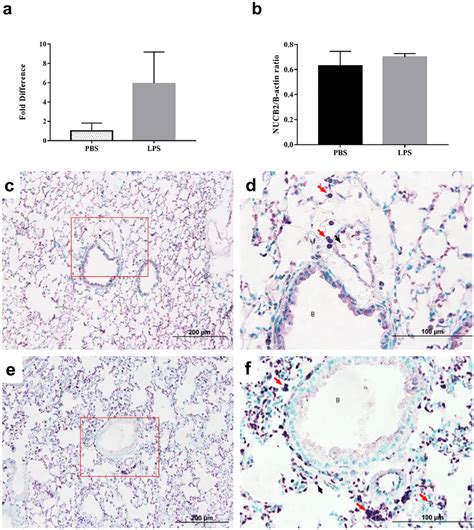 Quantification Of Nucb Nesfatin A Mrna Expression Through Rt Qpcr