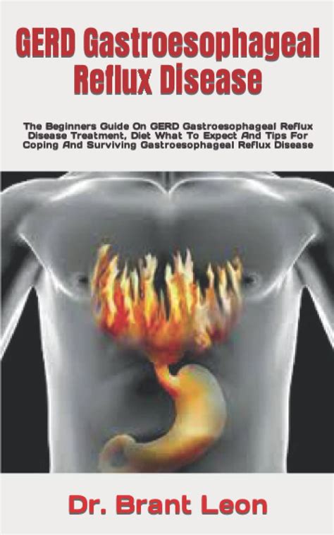 Buy Gerd Troesophageal Reflux Disease The Beginners Guide On Gerd