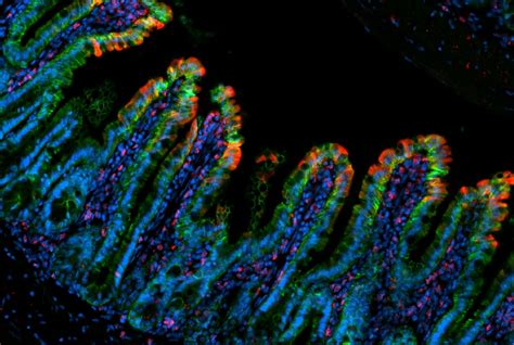 Intoxicación Por Consumo De Carnes Y Achuras Confirmaron La Infección Por Salmonella En El