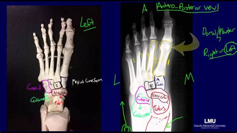 Ankle X Ray Anatomy - Anatomy Reading Source