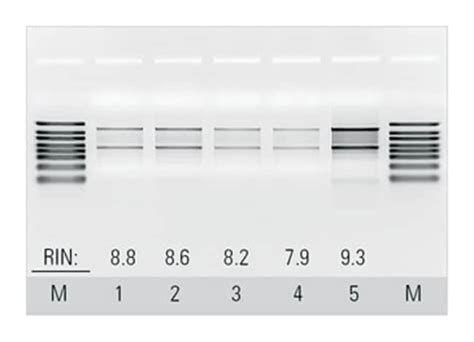 Thermo Scientific™ Buffers For Genejet™ Blood Rna Kit Biochemicals And