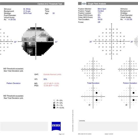 This Figure Shows The 24 2 Humphrey Visual Fields Left Eye Left And