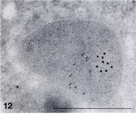 Figure 1 From Immunoelectron Microscopic Study Of A New D Amino Acid