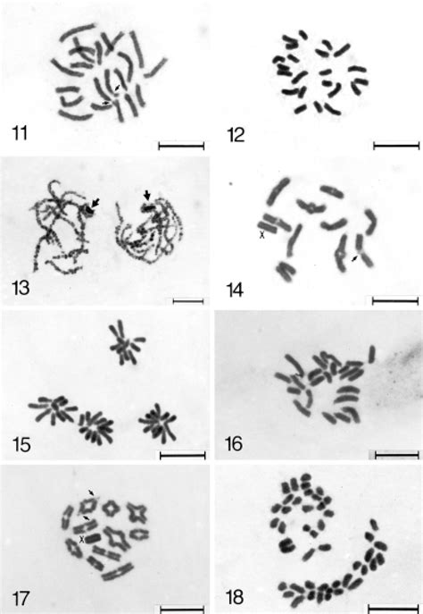 Oxyopes Macilentus Figs Taipei Population Spermatogonial