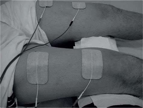 A Simpler And Shorter Neuromuscular Electrical Stimulation Protocol