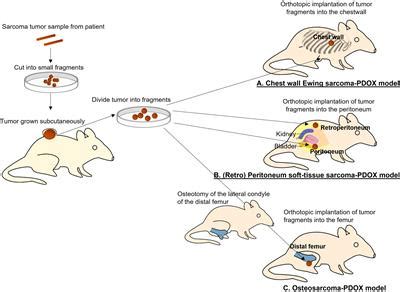 Frontiers Review Precise Sarcoma Patient Derived Orthotopic