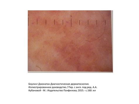 Общая дерматология. Диагностическая дерматоскопия - презентация онлайн