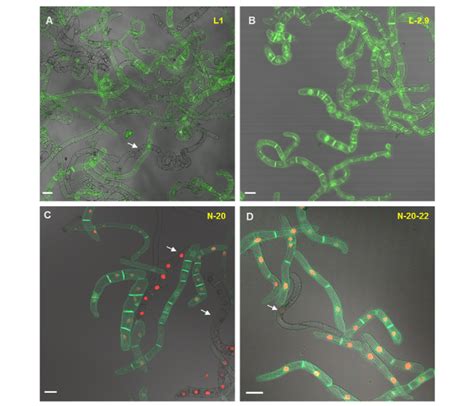 GFP And RFP Fluorescence In Primary And Secondary Suspensions A And