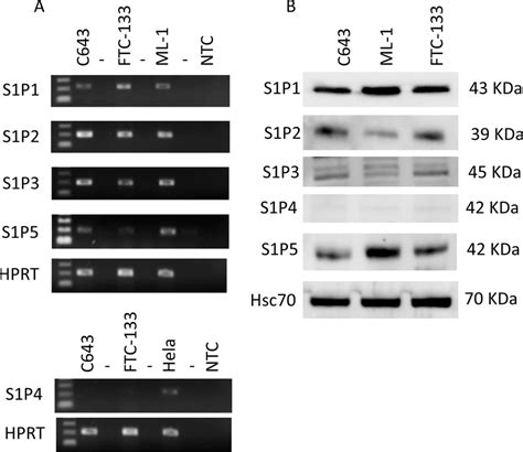 Expression Of S1P Receptors In Human Thyroid Cancer C643 And FTC 133