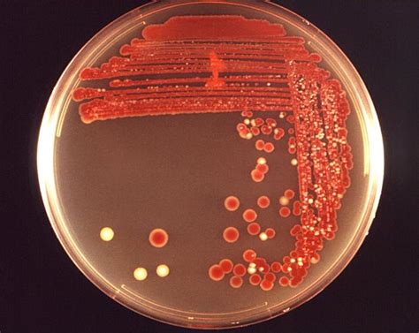 Serratia - wikidoc