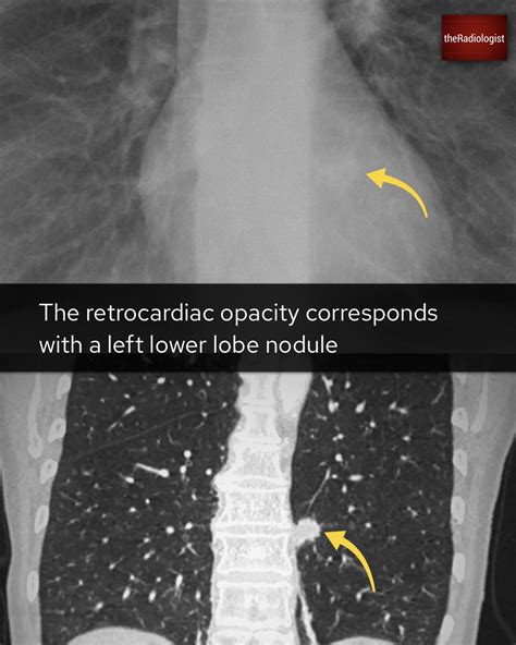 Theradiologist On Twitter Case Explanation