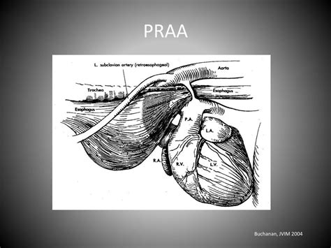 PPT - Persistent Right 4 th Aortic Arch PowerPoint Presentation, free download - ID:4801645