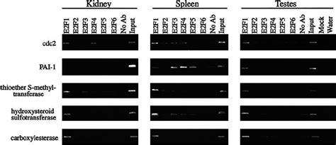 Analysis of the binding of E2F1 to target promoters in different ... 