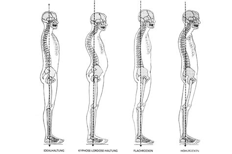 Cp Fehlhaltungen Sw Challenge Pilates Yoga