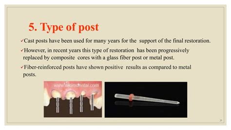 Ferrule Effect Ppt