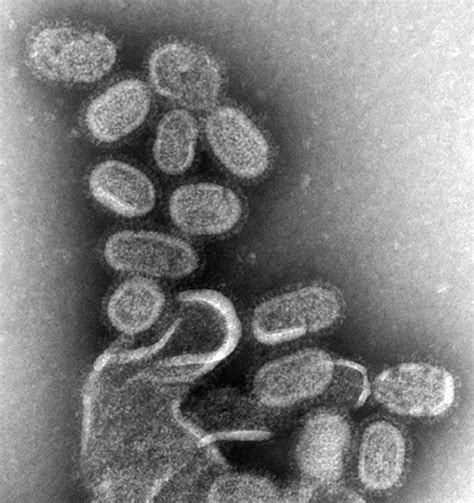 File:EM of influenza virus.jpg - Wikipedia, the free encyclopedia