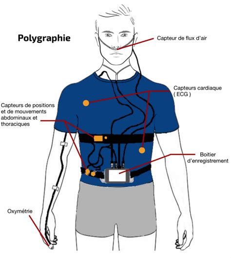 Savez vous comment dépister l apnée du sommeil R Sud Medical