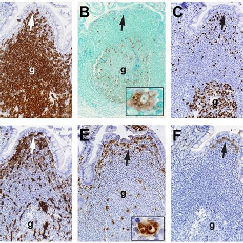 Morphology Of Uninfected Terminal Ileum Peyer S Patch B Cellinductive