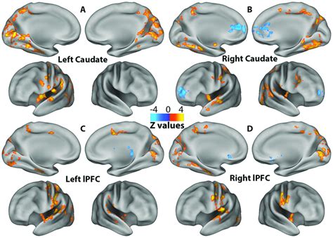 Figure S6 Frontal And Striatal Seed Based Connectivity Differences