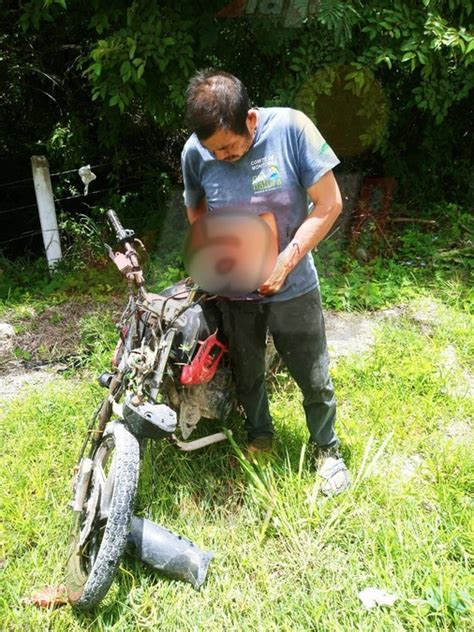 Motociclista sufre exposición de vísceras al derrapar su moto en la