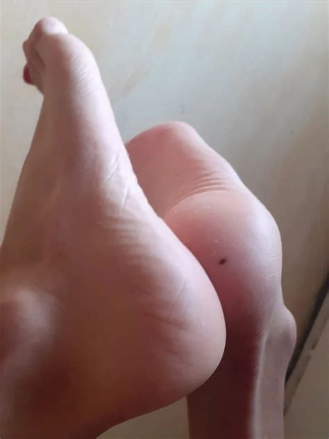 Sissy Feet 5 Nude Pics XHamster