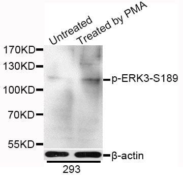 Polyclonal Mapk6 Antibody MyBioSource