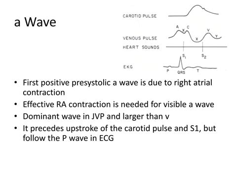 PPT - Jugular venous pressure and waveforms PowerPoint Presentation, free download - ID:634655