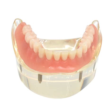 Di Overdenture Di Modeli Kar Labilir Mandibular D K Di Modeli