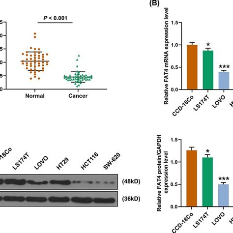 The Expression Of FAT4 In CRC Tissues And Cells A The Expression Of