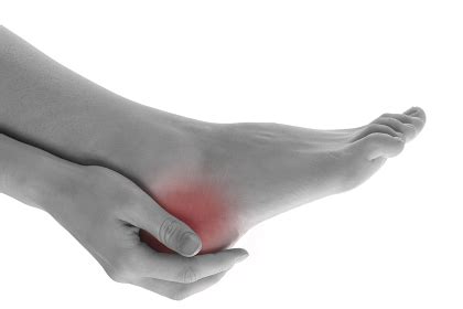 What Is This Painful Bump on My Heel? | Podiatry Center of New Jersey