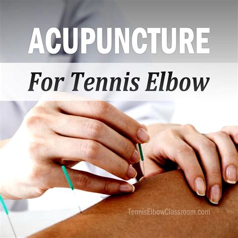 Tennis Elbow Classroom Is Acupuncture Effective For Treating Tennis Elbow