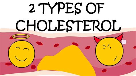 2 Types Of Cholesterol Good Vs Bad Cholesterol Youtube