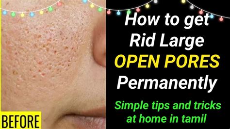 How To Get Rid Large Open Pores At Home Clear ஆக்கும் Youtube